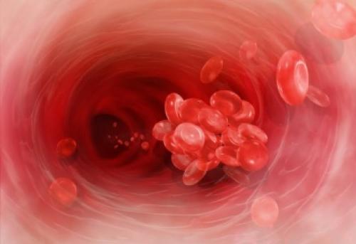 Как повысить свертываемость крови в домашних условиях. Как повысить свертываемость крови