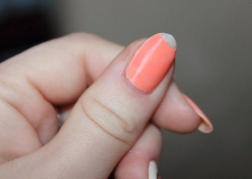 Почему отслаивается гель с ногтей. Почему отслаивается гель-лак от ногтей: причины и особенности